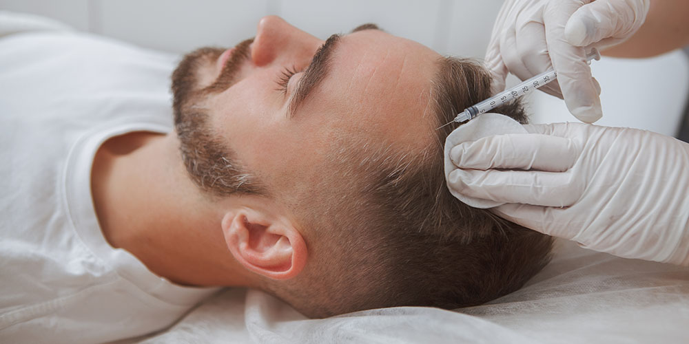 PRP for Hair Restoration